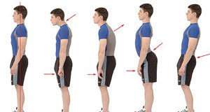 Center for the screening spine deformities in children