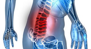 Spinal column surgery