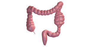 Colon surgery