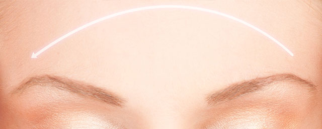 Eyebrow lift