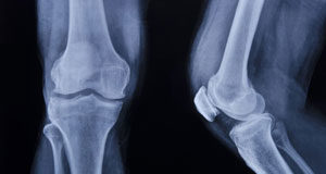 Rentgen dijagnostika i mamograf