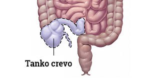 Hirurgija tankog creva