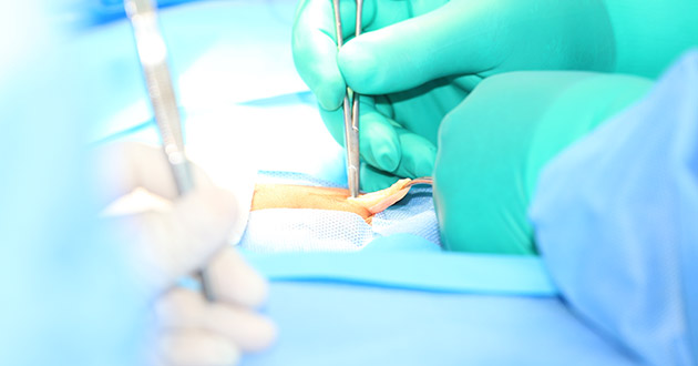 Operacija kile u Atlas bolnici