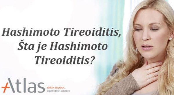 Hasimoto tireoiditis