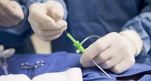 interventna-radiologija