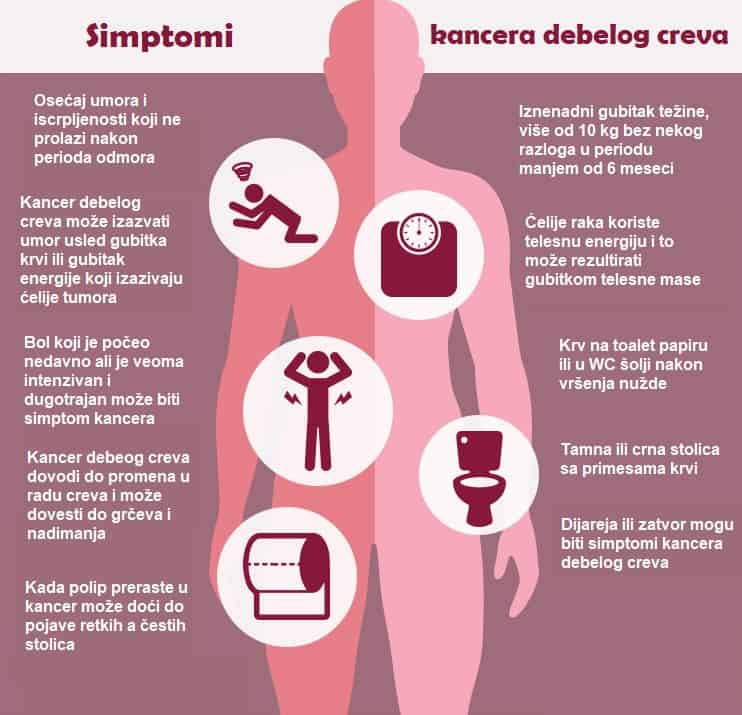 Simptomi raka debelog creva Simptomi raka debelog creva