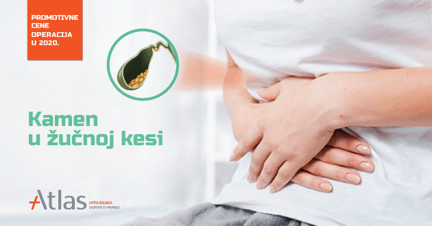 Laparoskopska operacija žučne kese