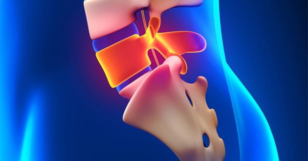 Spinalna hirurgija - Atlas opšta bolnica Spinalna hirurgija - Atlas opšta bolnica