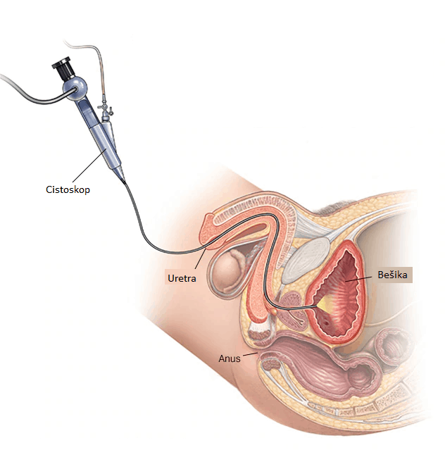 Muška cistoskopija