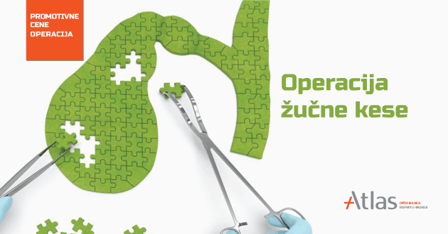 gallbladder surgery Atlas hospital operacija žučne kese Atlas bolnica