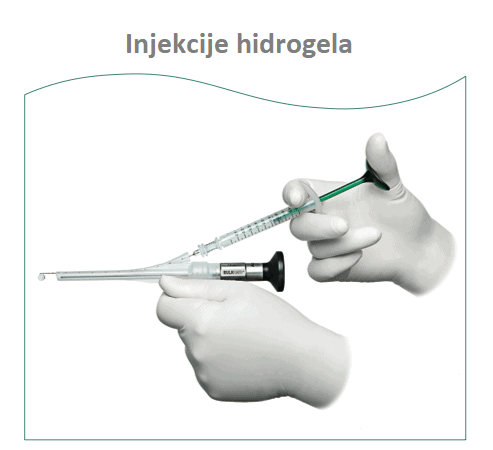 Hydrogel injections for stress urinary incontinence Hydrogel injections for stress urinary incontinence