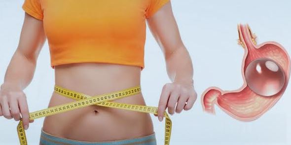 Smršajte lako uz balon za mršavljenje Smršajte lako uz balon za mršavljenje